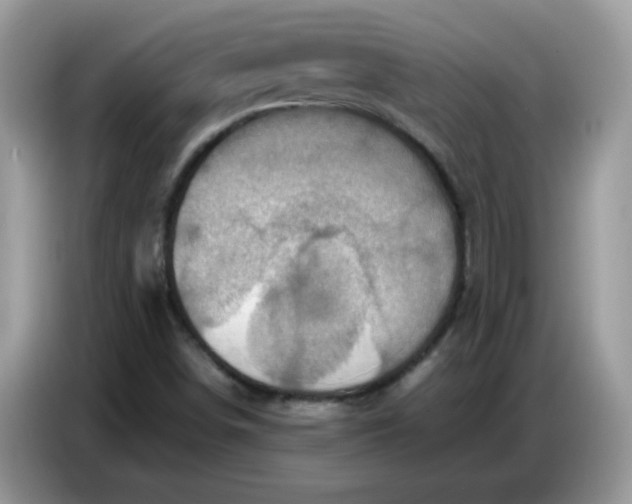 X0000086771498200704271739