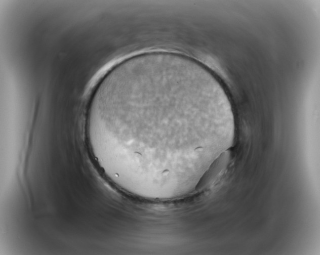X0000086771504200704271740