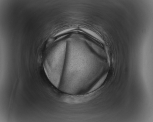 X0000086770033200705041517