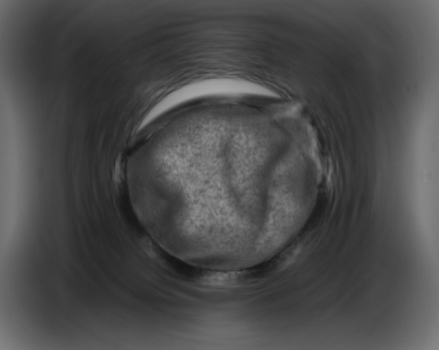 X0000086770084200705041516