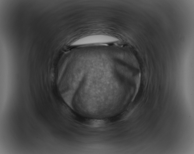 X0000086770085200705041516