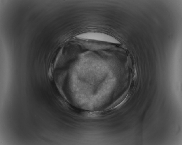 X0000086770094200705041516