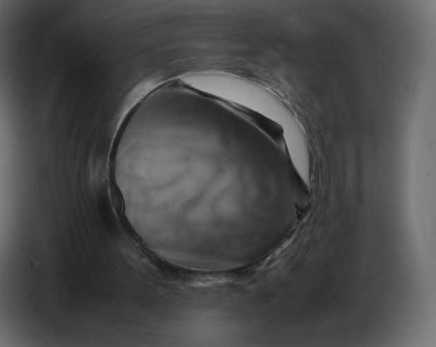 X0000086770099200705041516