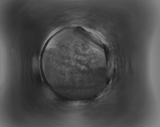 X0000086770100200705041516
