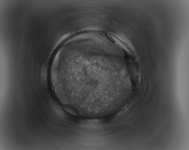X0000086770108200705041516