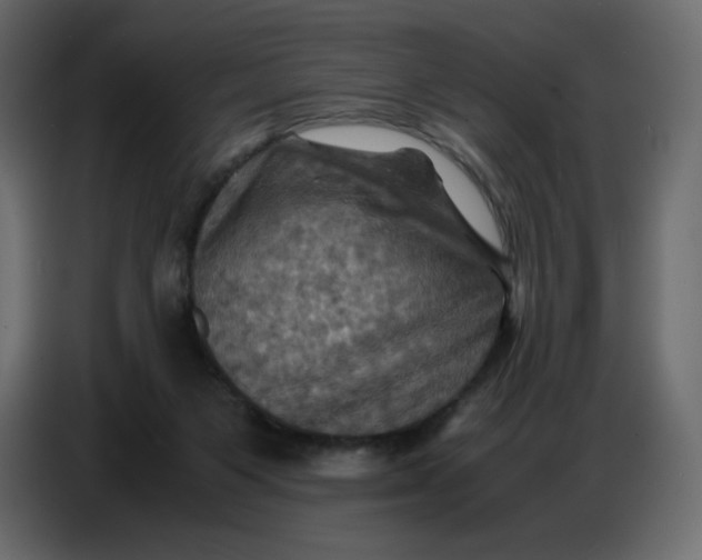 X0000086770119200705041516