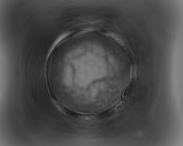 X0000086770147200705041515
