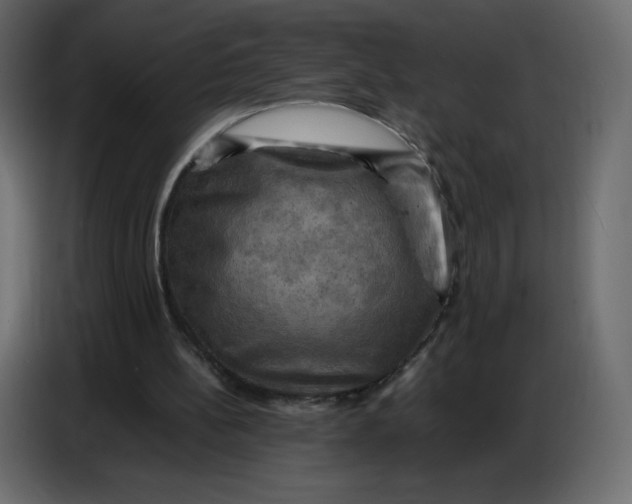 X0000086770148200705041515