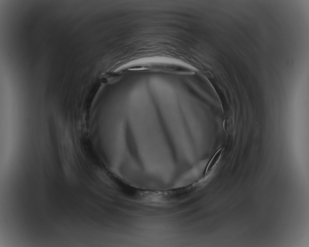 X0000086770182200705041515