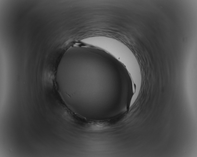 X0000086770235200705041514