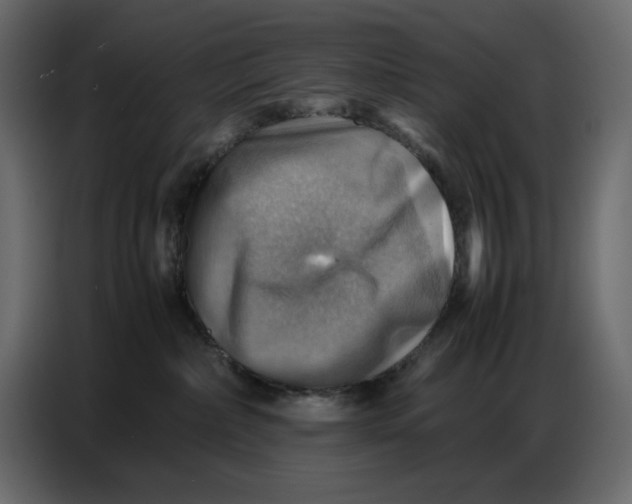X0000086770236200705041514