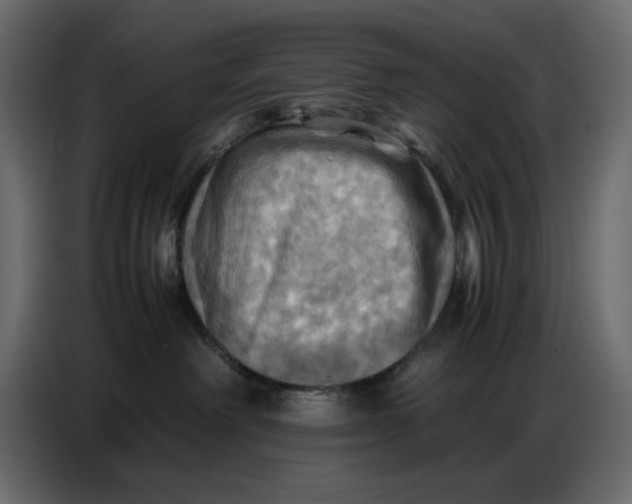 X0000086770238200705041514