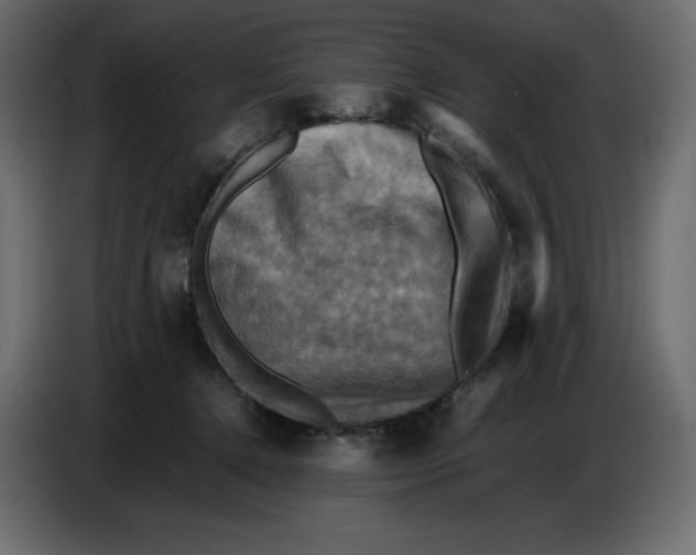 X0000086770368200705041513
