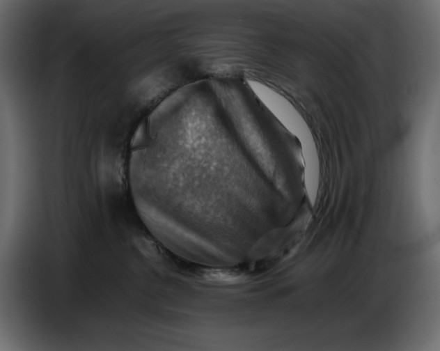 X0000086770380200705041513