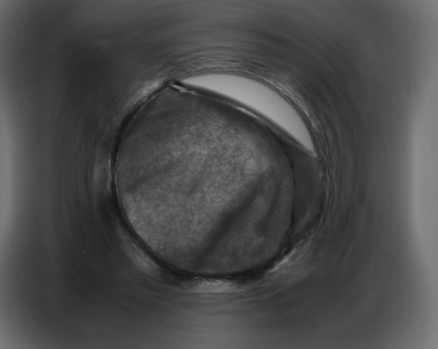 X0000086770397200705041512