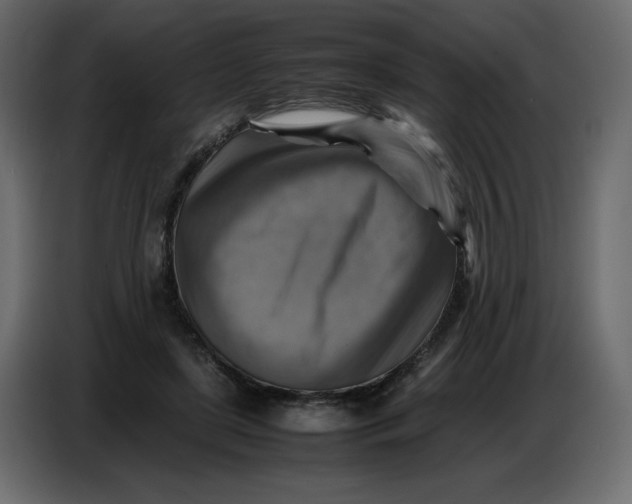 X0000086770451200705041511