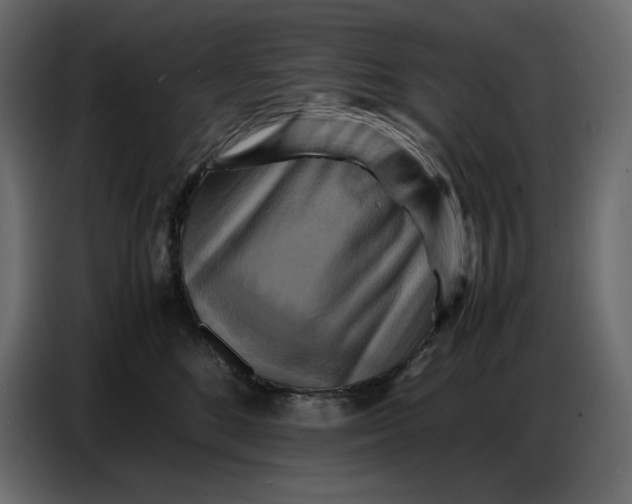 X0000086770520200705041510