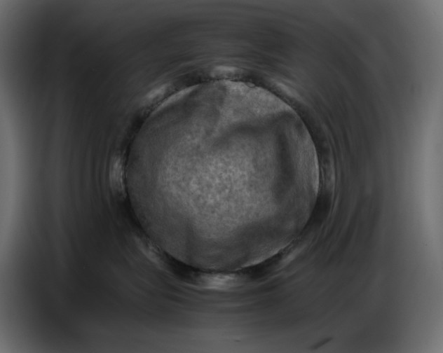 X0000086770575200705041510
