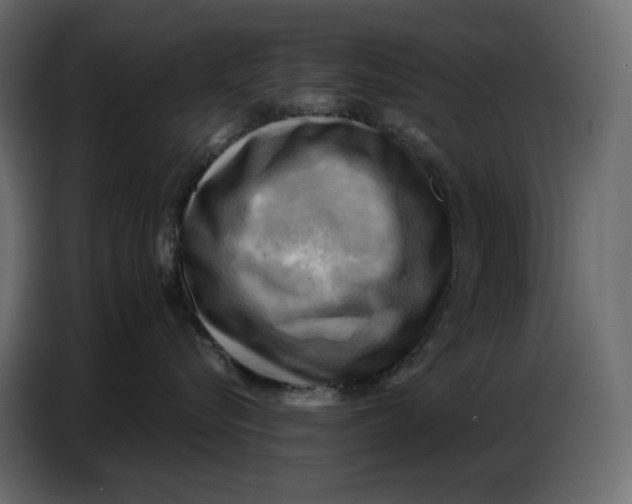 X0000086770576200705041510