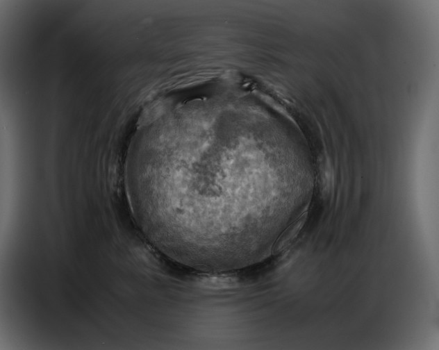 X0000086770619200705041509