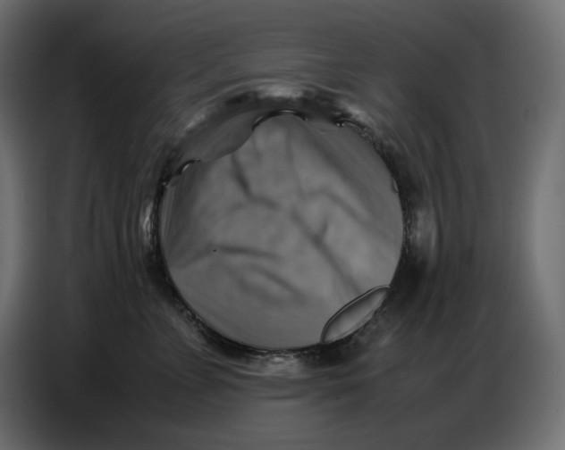 X0000086770715200705041508