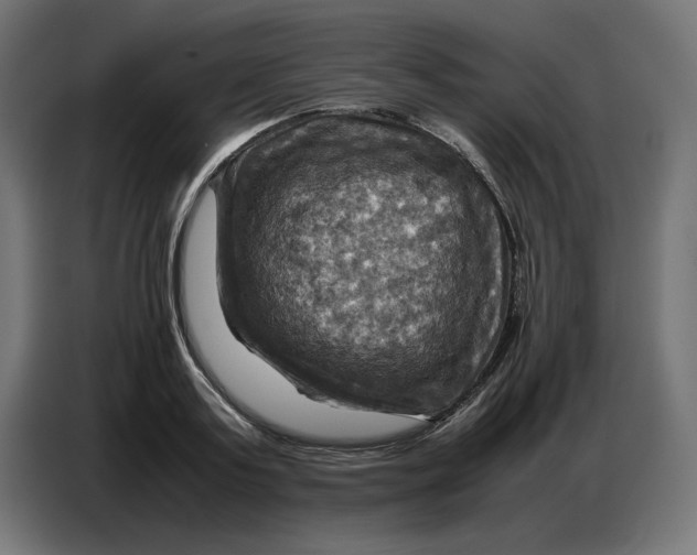 X0000086770795200705041507