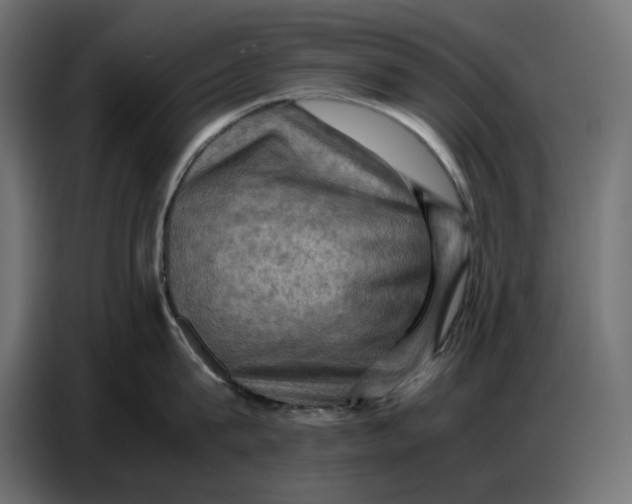 X0000086770815200705041507