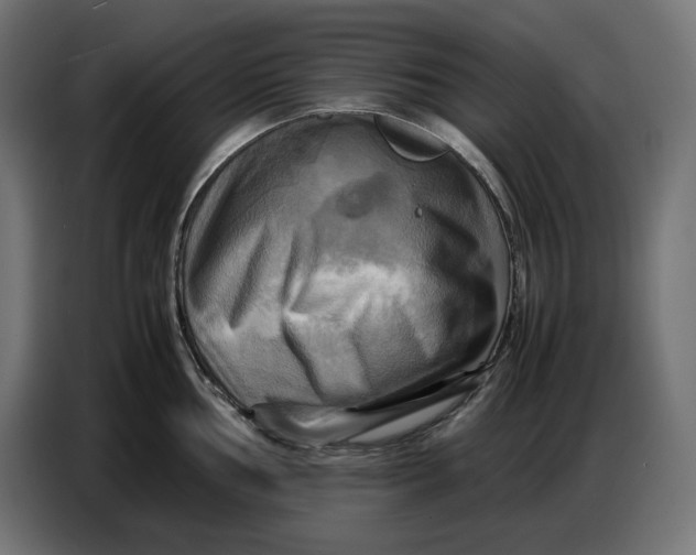 X0000086771002200705041504
