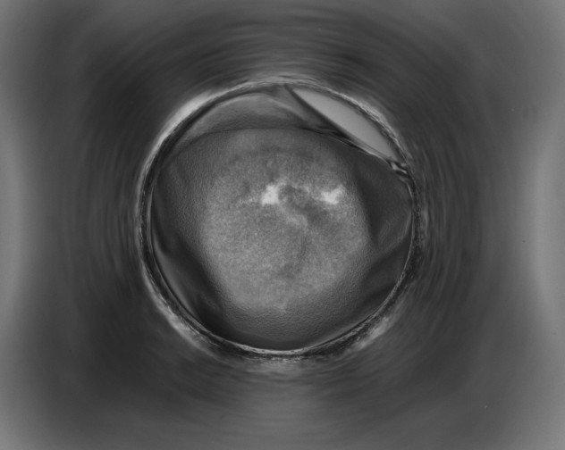 X0000086771038200705041504