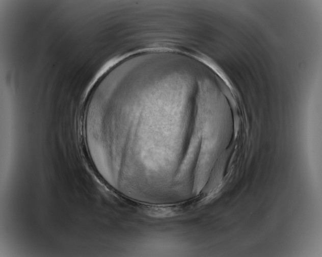 X0000086771101200705041503