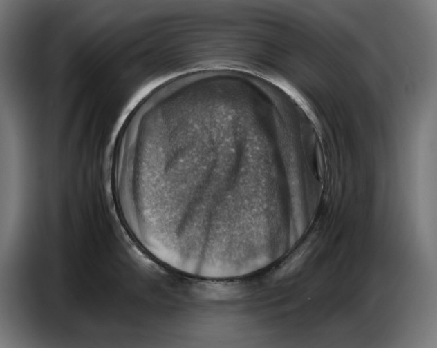 X0000086771102200705041503