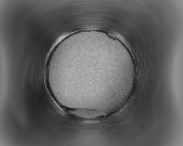 X0000086771187200705041502