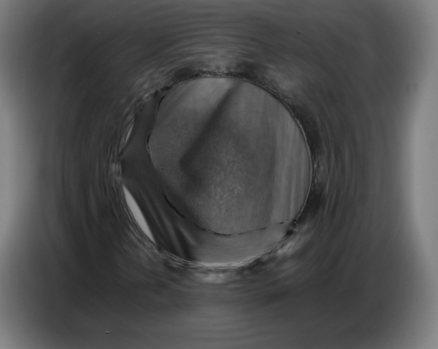 X0000086771202200705041501