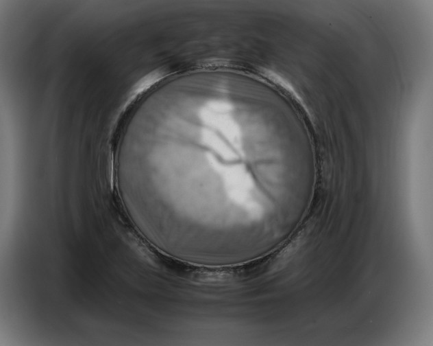 X0000086771219200705041501