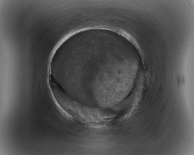 X0000086771520200705041458
