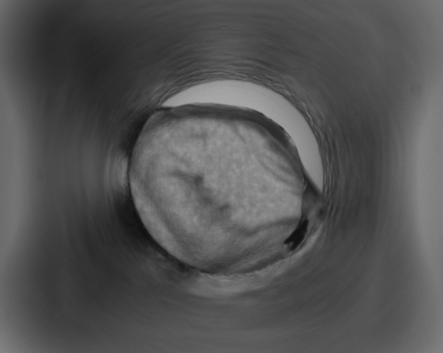 X0000086770041200705111744