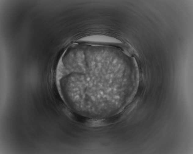 X0000086770093200705111744