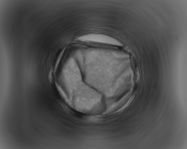 X0000086770094200705111744