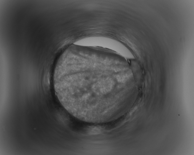 X0000086770115200705111743