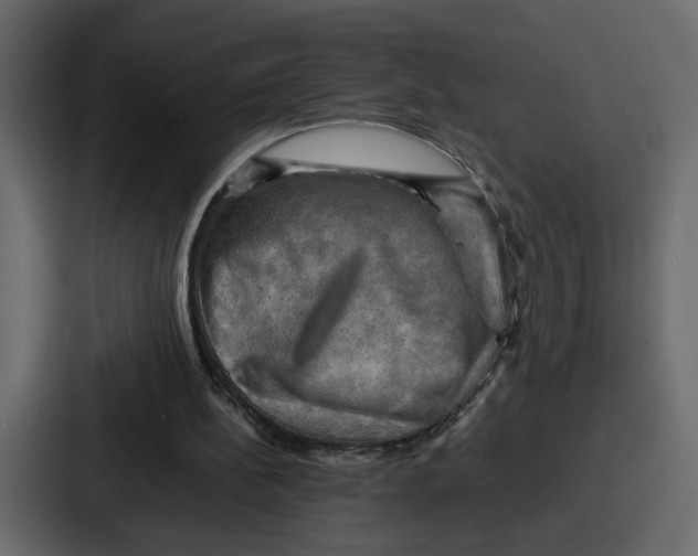 X0000086770148200705111742