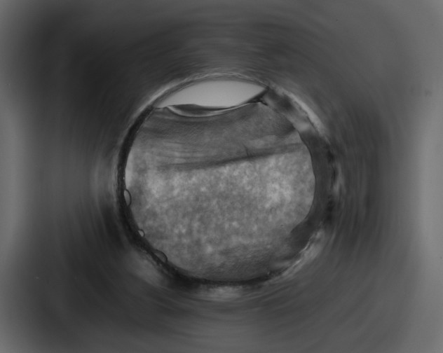 X0000086770156200705111742