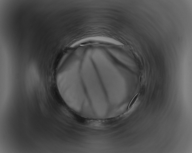 X0000086770182200705111742