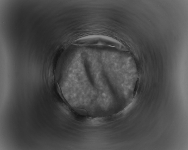 X0000086770186200705111742