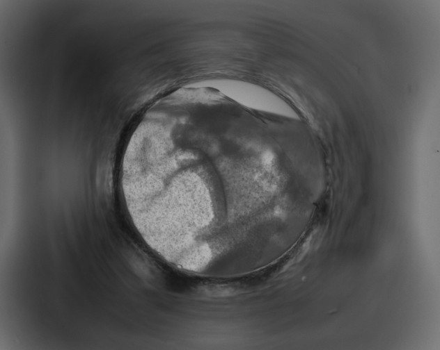 X0000086770299200705111740
