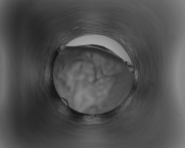 X0000086770331200705111740