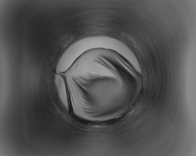 X0000086770364200705111740