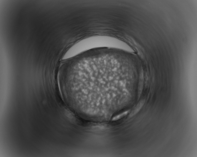 X0000086770377200705111740