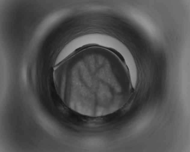 X0000086770382200705111740