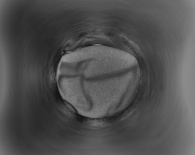 X0000086770384200705111740