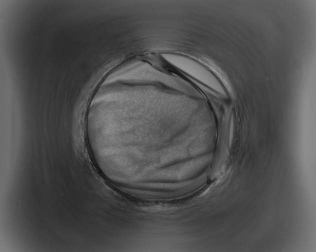X0000086770385200705111739